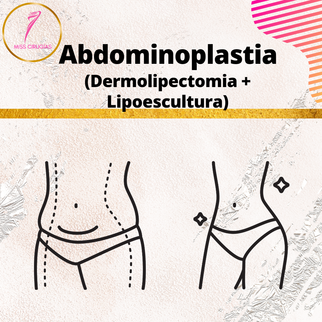 liposuccion-lipoescultura-dermolipectomia