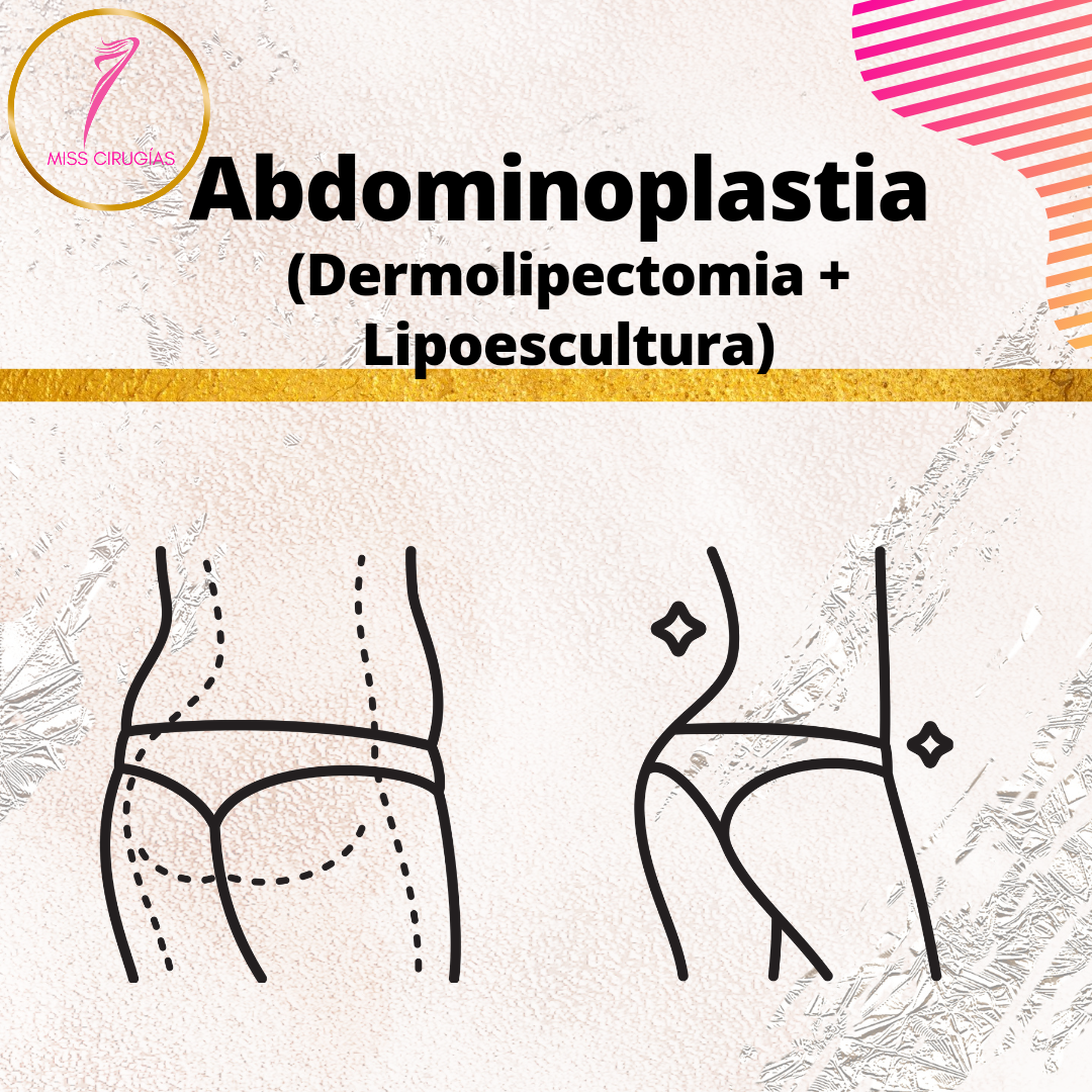 liposuccion-lipoescultura-dermolipectomia