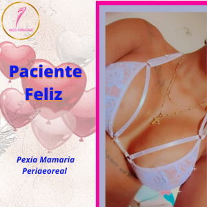 Mamoplastia de aumento-pexia-mastopexia-misscirugias