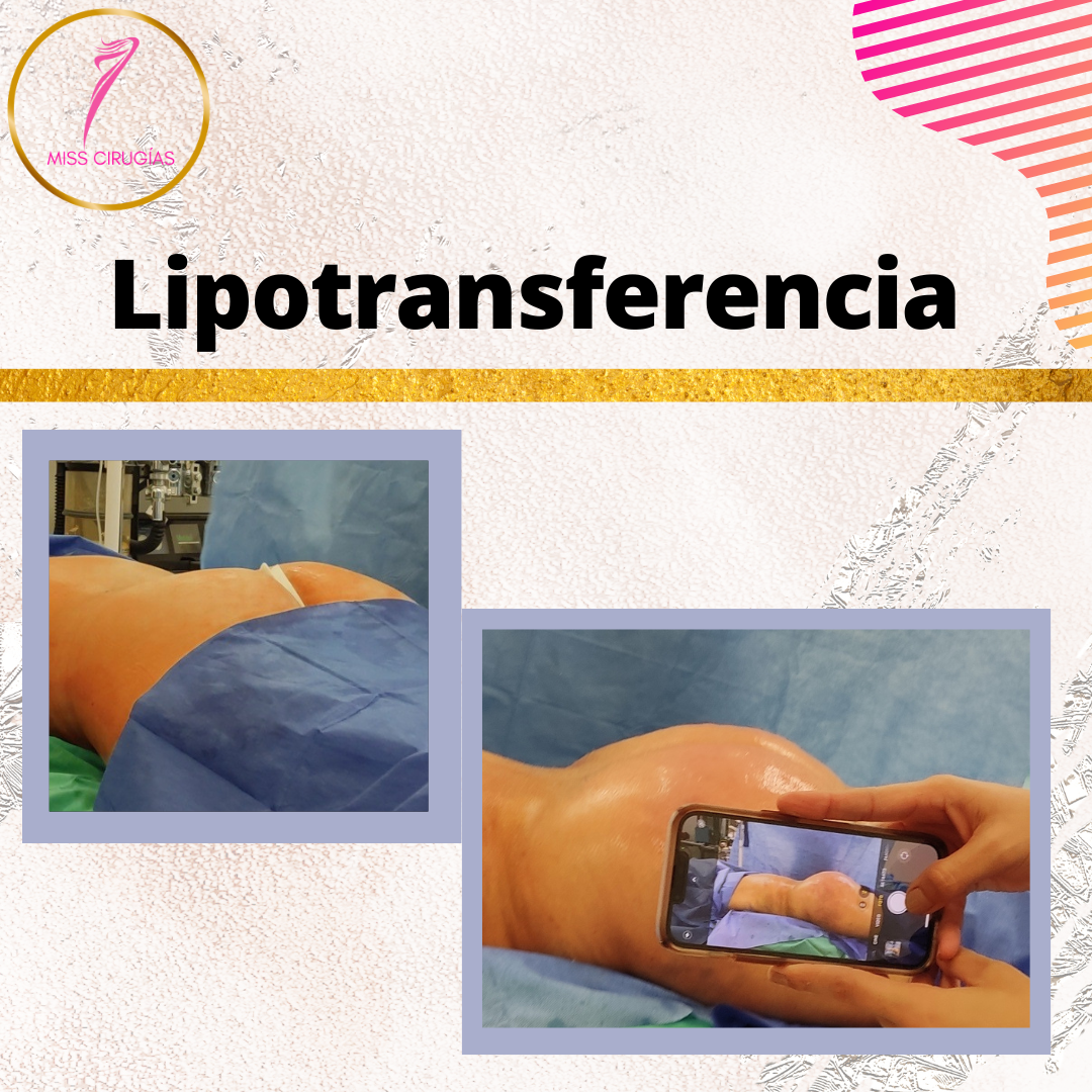 mamoplastia-lipo-lipoesultura-cirugia-plastica